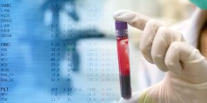 Image of a hand holding a test tube of platelets